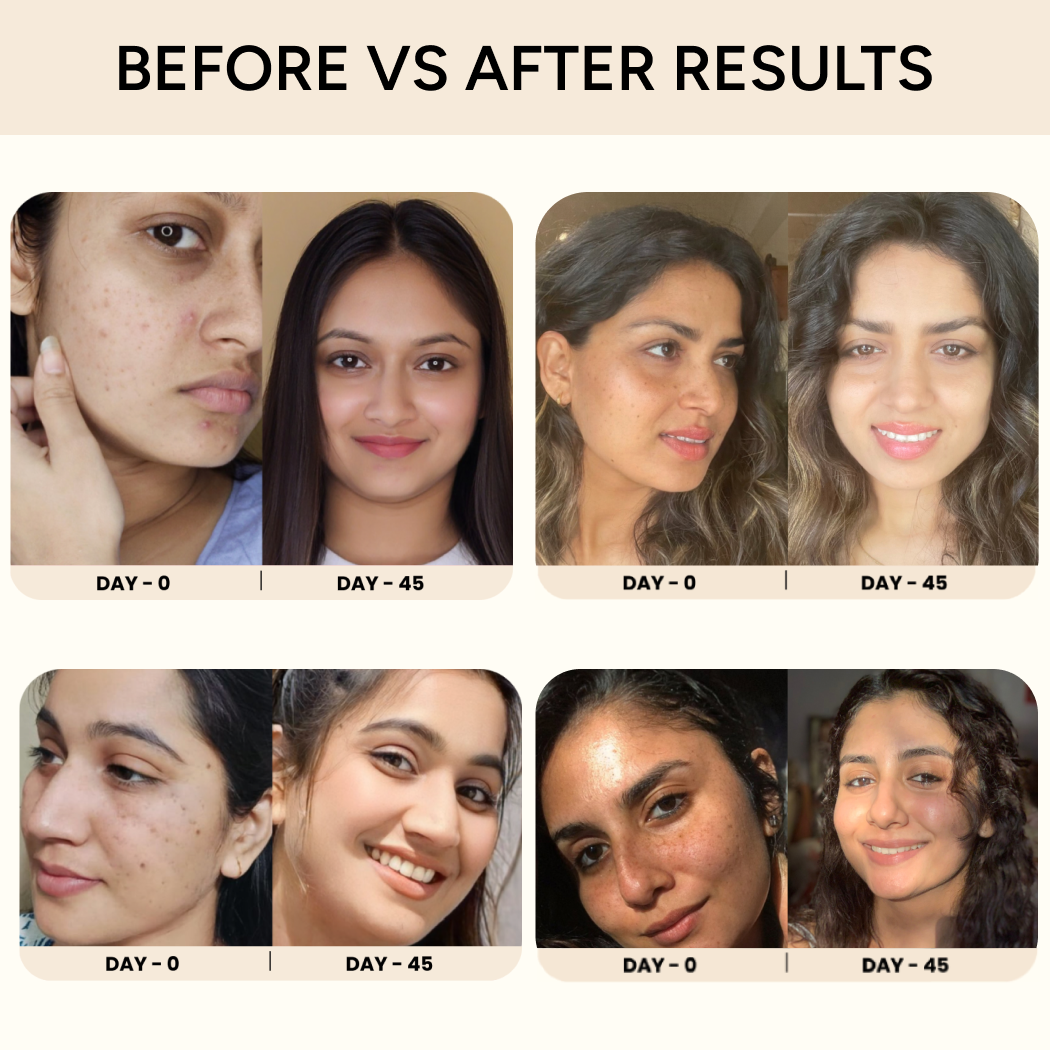 NuEssentials Melting Nano Mask